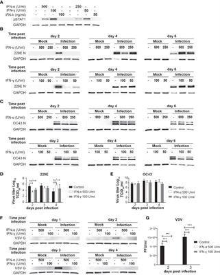 Interferon regulatory factor 3 mediates effective antiviral responses to human coronavirus 229E and OC43 infection